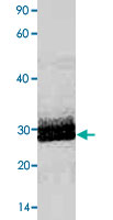 15% SDS-PAGE Stained with Coomassie Blue